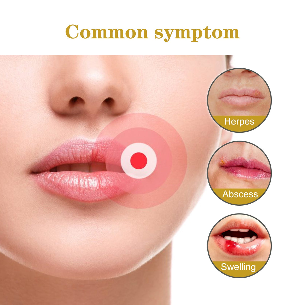 Cold Sore Patches: Invisible Hydrocolloid Lip Cover