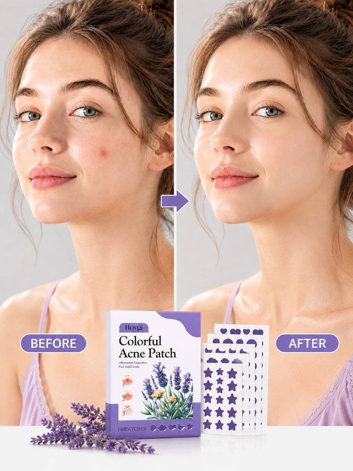 Colorful Acne Patches — Gentle Botanical Hydrocolloid