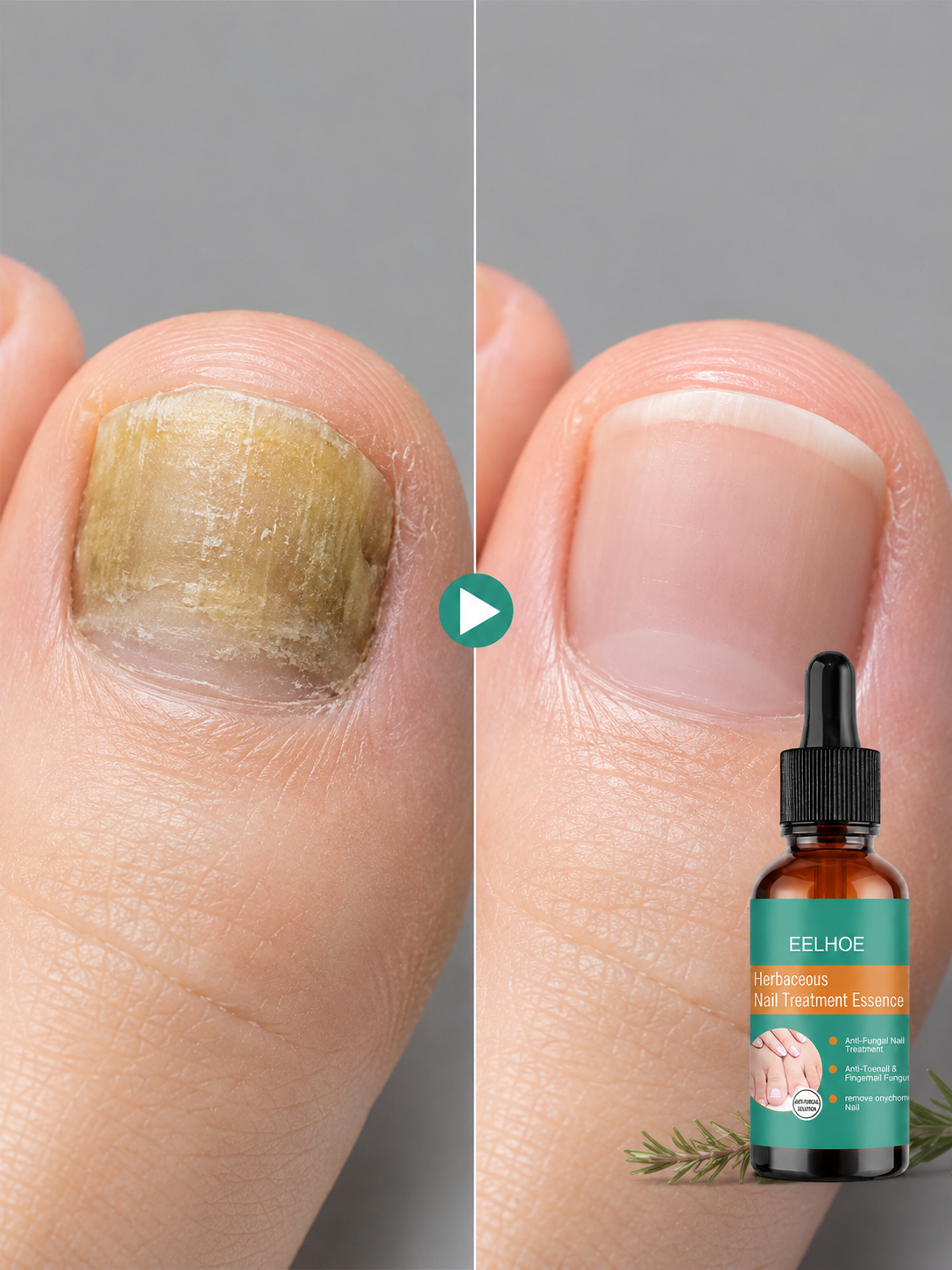 EELHOE Herbal Nail Essence Serum