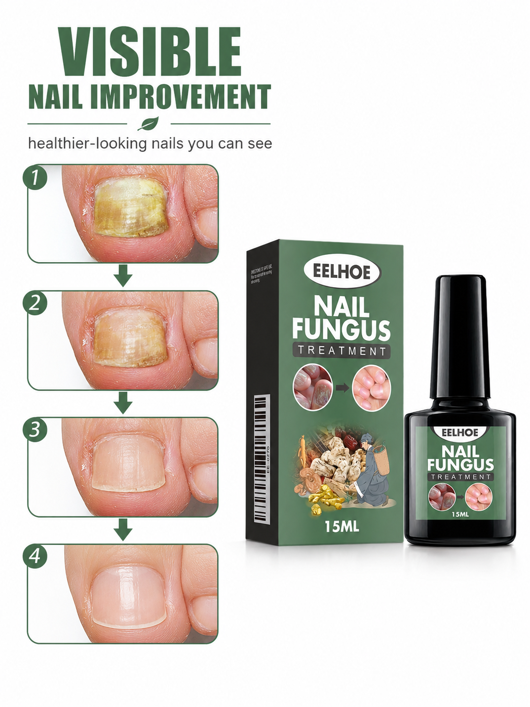 EELHOE Gentle Nail Care Solution
