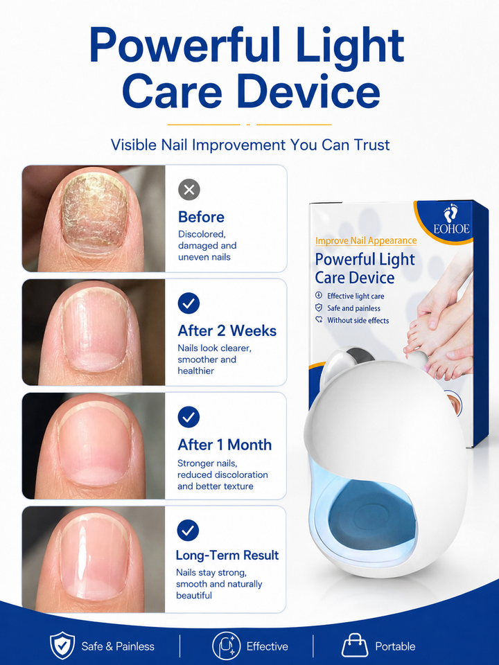 LED Nail Light Therapy Device — Clear Yellow Nails at Home