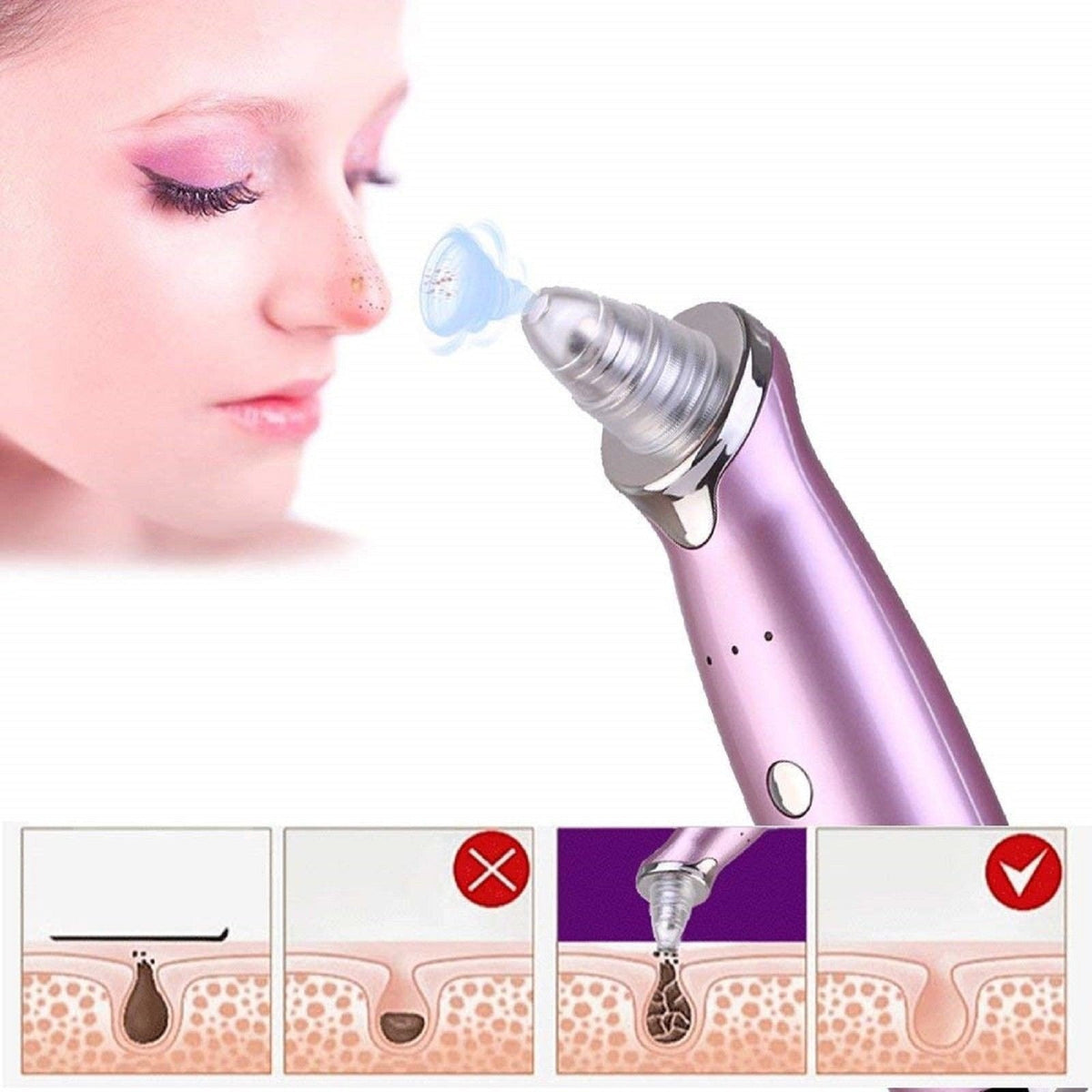 Electric Pore Cleanser — Deep Blackhead Removal at Home