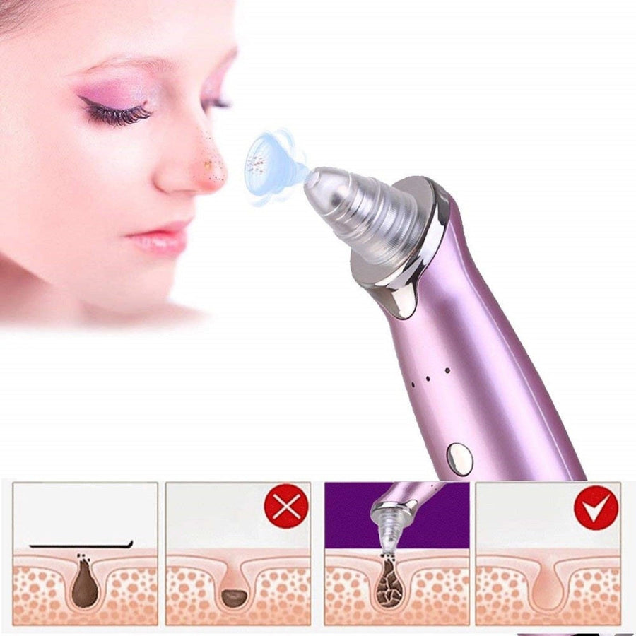 Electric Pore Cleanser — Deep Blackhead Removal at Home