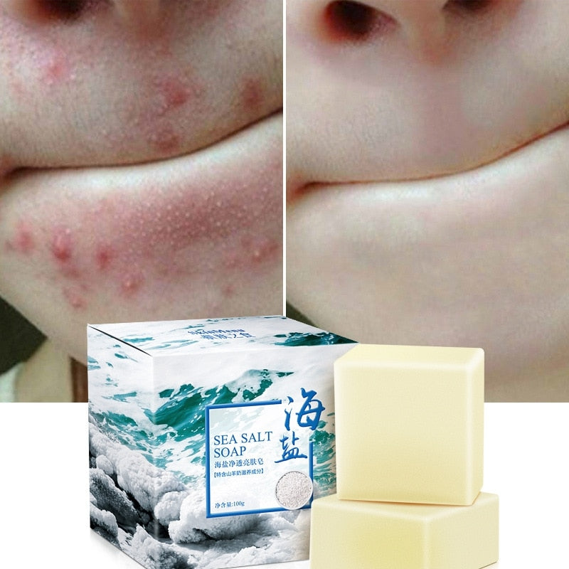 Sea Salt Soap for Soft, Clean, Balanced-Looking Skin