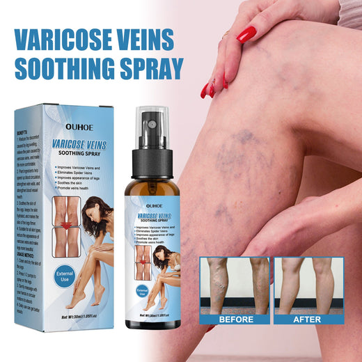 Leg Vein Treatment Spray — Relieve Soreness & Visibly