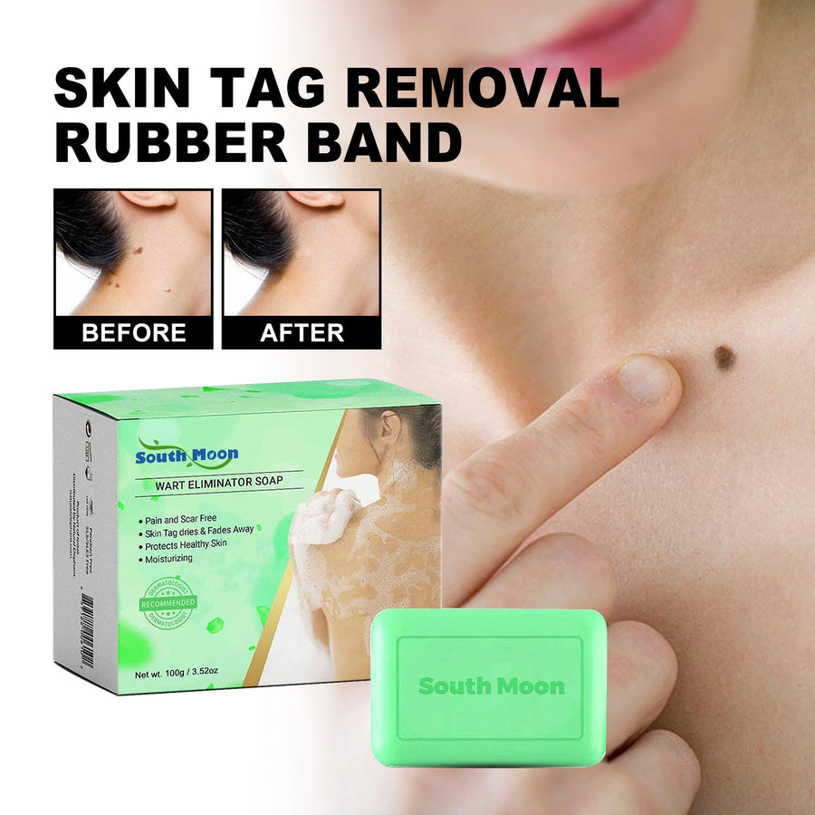 Skin Tag & Wart Removal Soap — Pain & Scar-Free Treatment