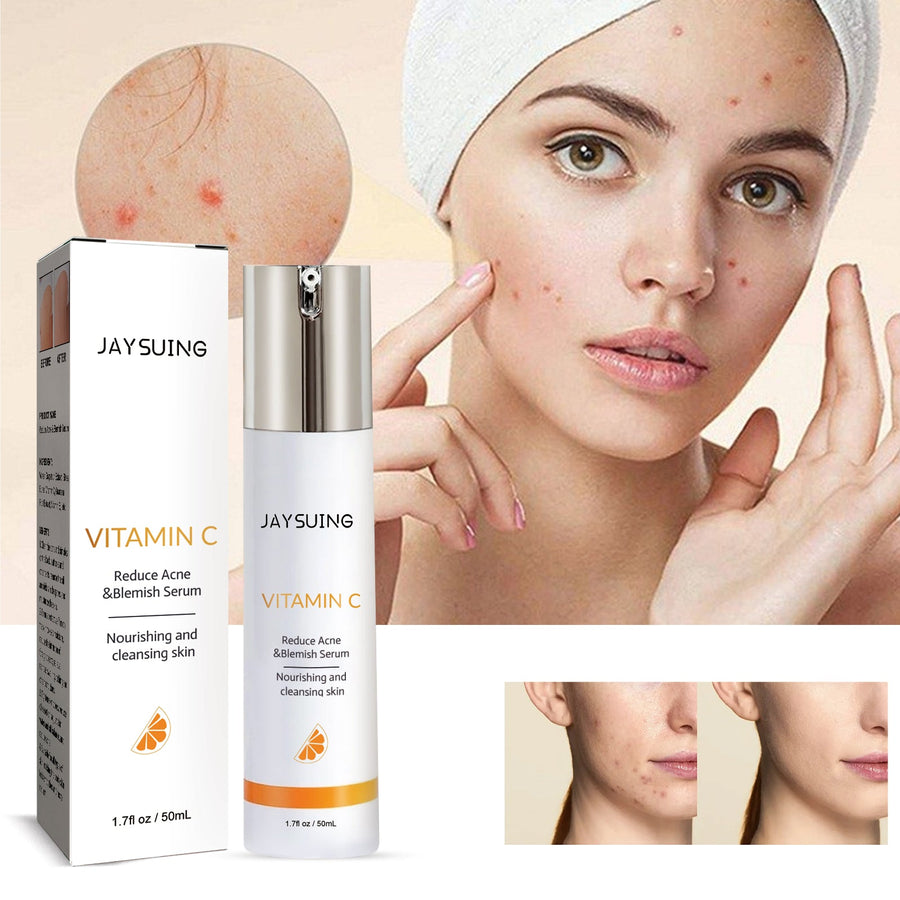 Vitamin C Acne Serum for Clearer, Nourished-Looking Skin