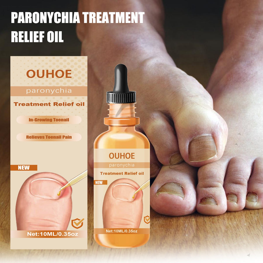 Nail Treatment Oil — Relieves In‑Growing Toenails