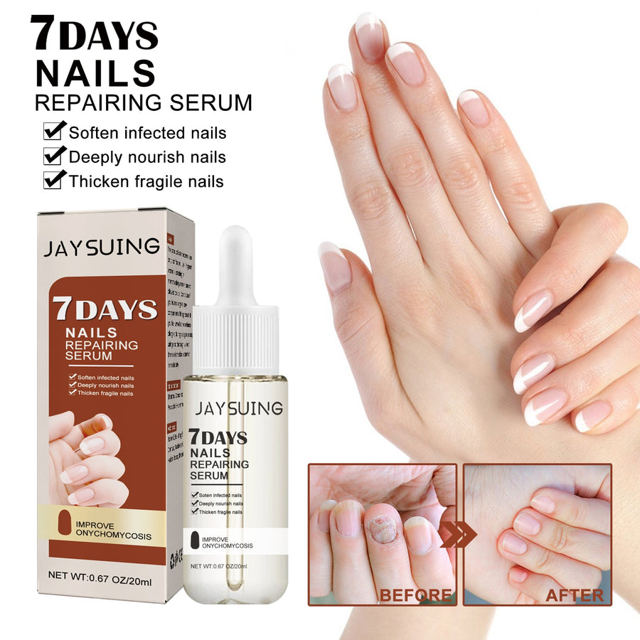 Nail Repair Serum for Stronger, Hydrated, Healthy Nails