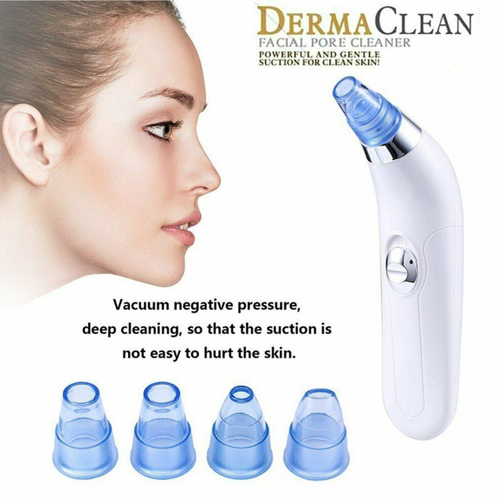 Pore Vacuum Blackhead Remover — Pain-Free Deep Cleaning