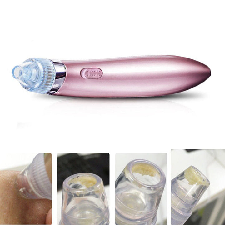 Pore Vacuum Blackhead Remover — Clearer Skin in 2 Weeks