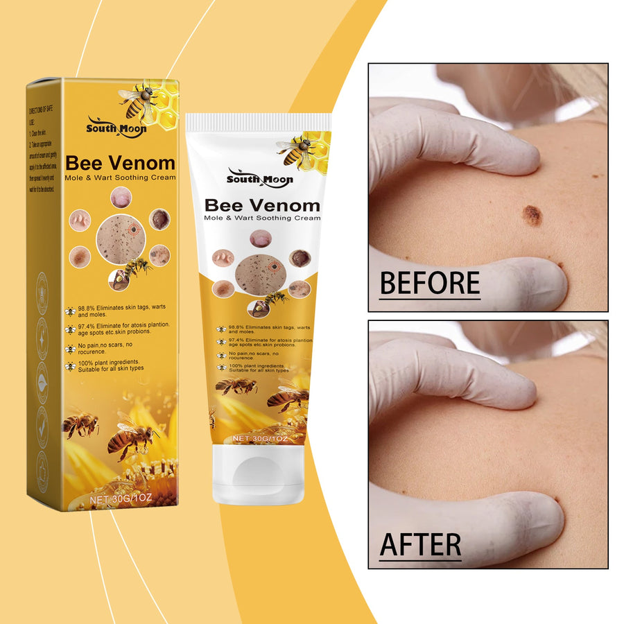 Bee Venom Mole & Wart Removal Cream — 98.8% Efficacy