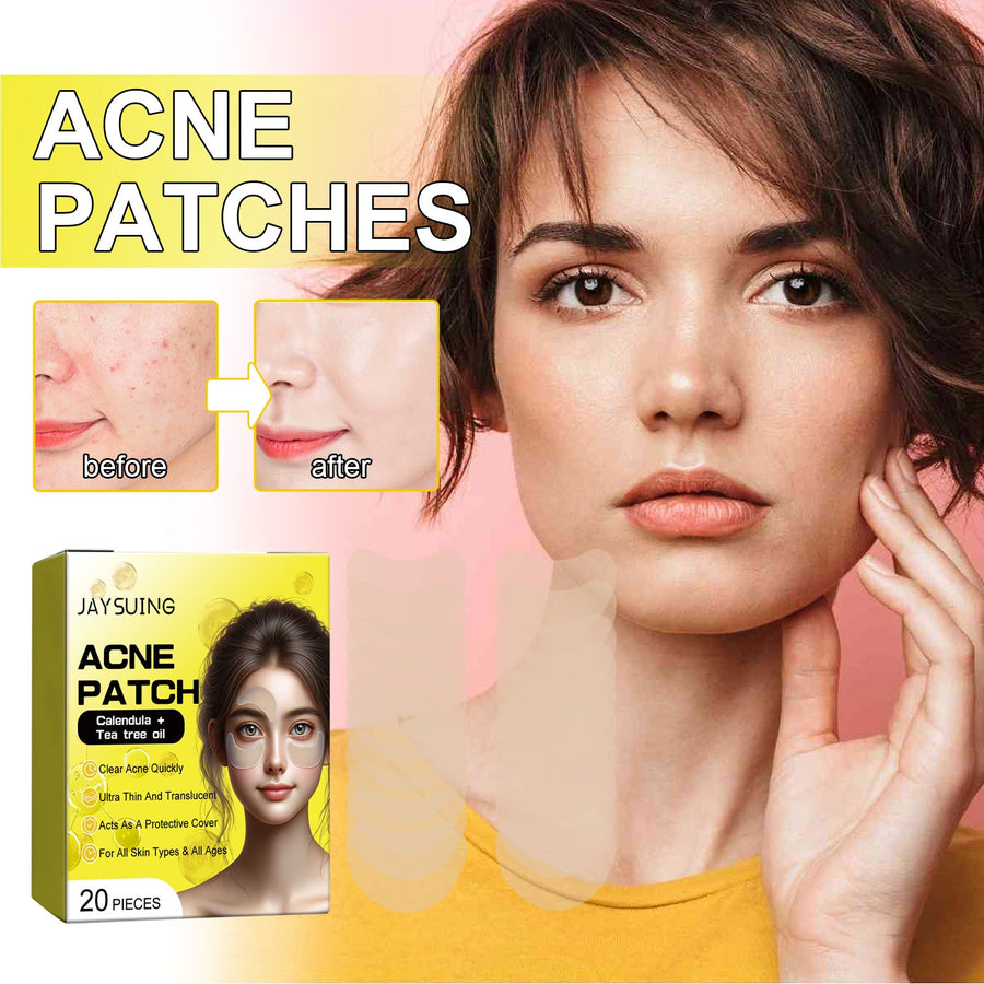 Hydrocolloid Acne Patches for Discreet Blemish Cover