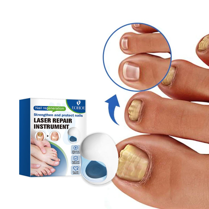 EOHOE Laser Nail Device for Fungal Nail Care at Home
