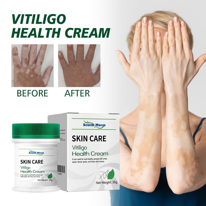 Vitiligo Care Cream for a More Even-Looking Skin Tone