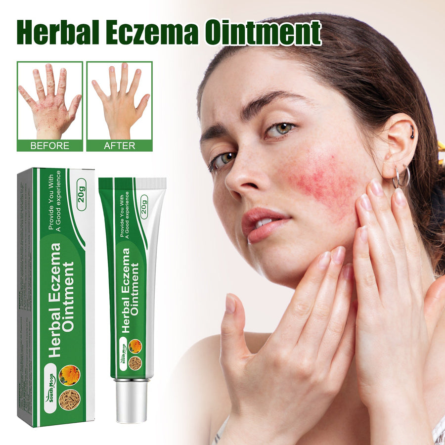 Eczema Ointment — Fast Itch Relief with Herbal Calendula Formula