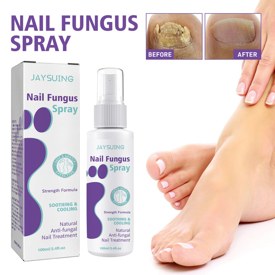 Nail Fungus Spray for Soothing Cooling Daily Nail Care