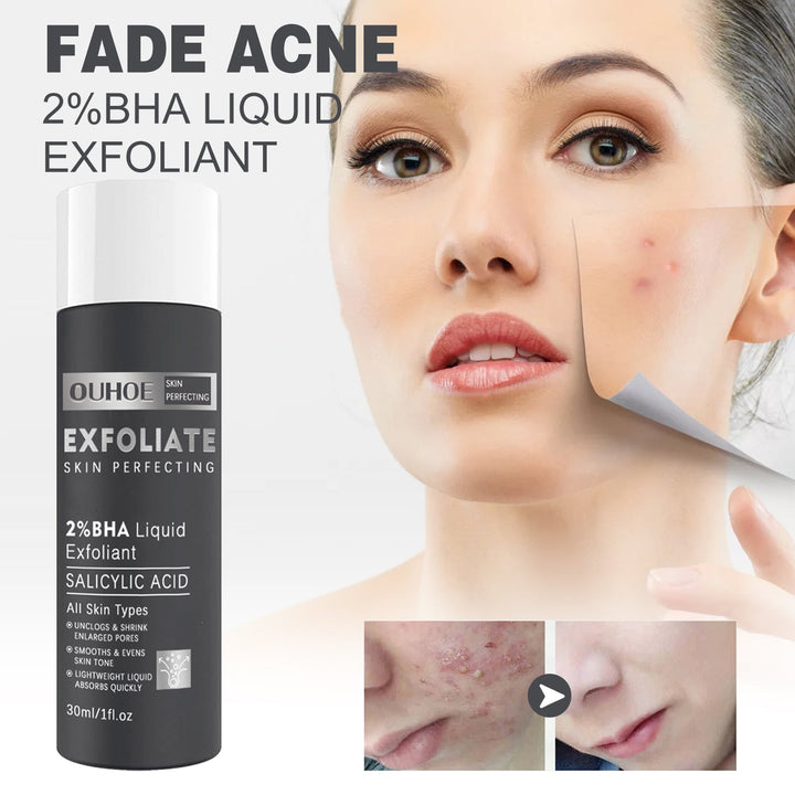 2% BHA Liquid Exfoliant for Clogged Pores & Acne