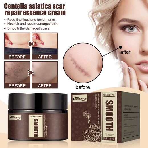 Centella Asiatica Scar Repair Cream — Fade Scars & Smooth Skin