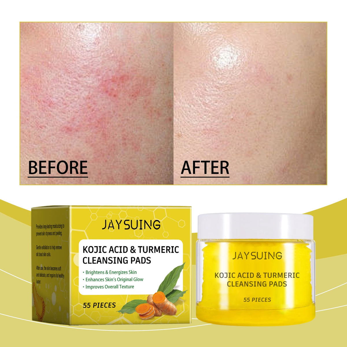Turmeric Cleansing Pads for Dull, Uneven Skin Tone