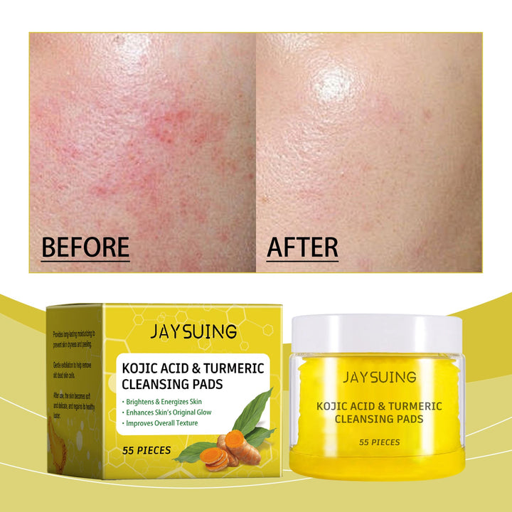 Turmeric Cleansing Pads for Dull, Uneven Skin Tone