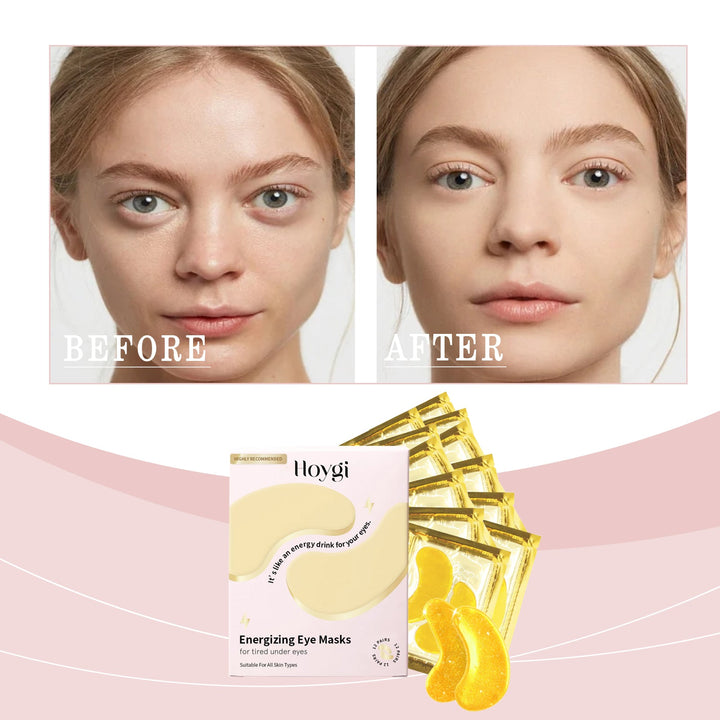 Hoygi Gold Eye Masks for Dark Circles & Puffiness