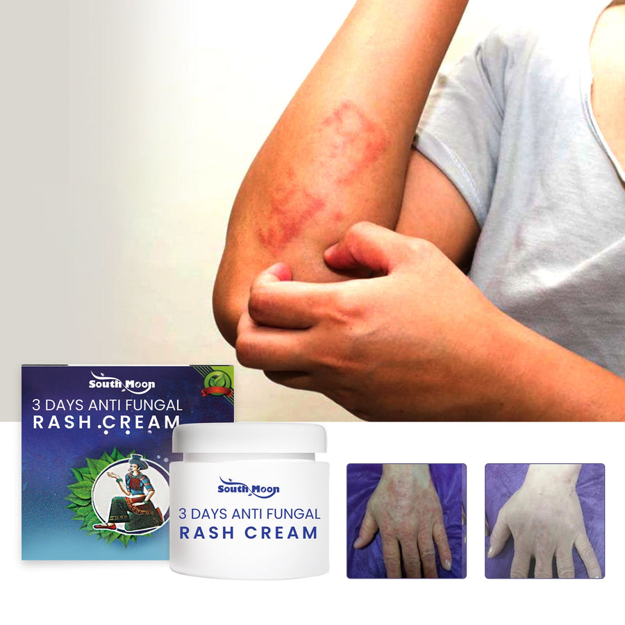 Anti-Fungal Rash Cream – 3-Day Relief & Instant Cooling