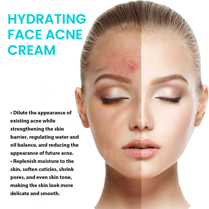 Brightening Acne Cream for Hydrated, Even-Looking Skin