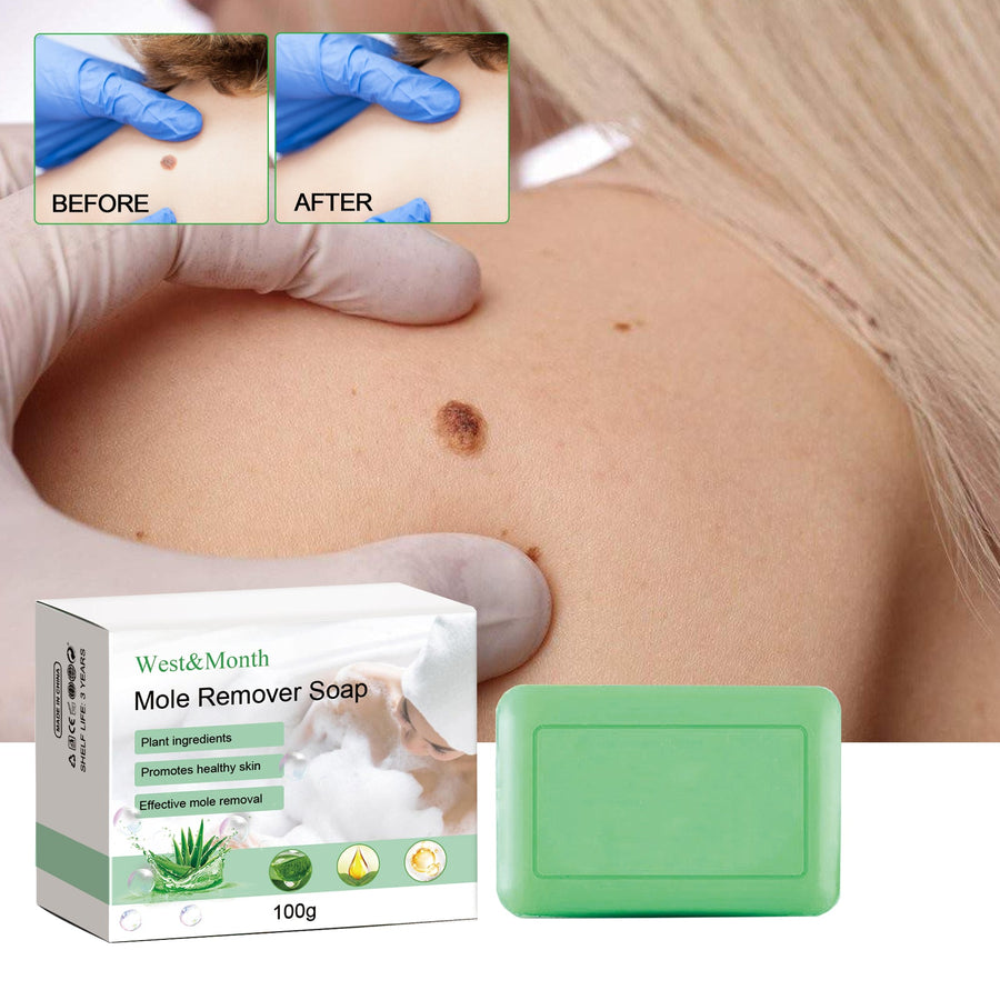 Mole Remover Soap — Painless, Scar-Free Wart & Blemish Removal