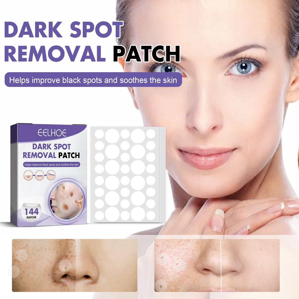 Dark Spot Patches for Melasma & Age Spots, 144-Pack