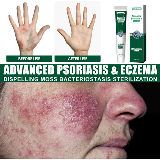 Herbal Soothing Cream for Dry, Itchy & Irritated Skin