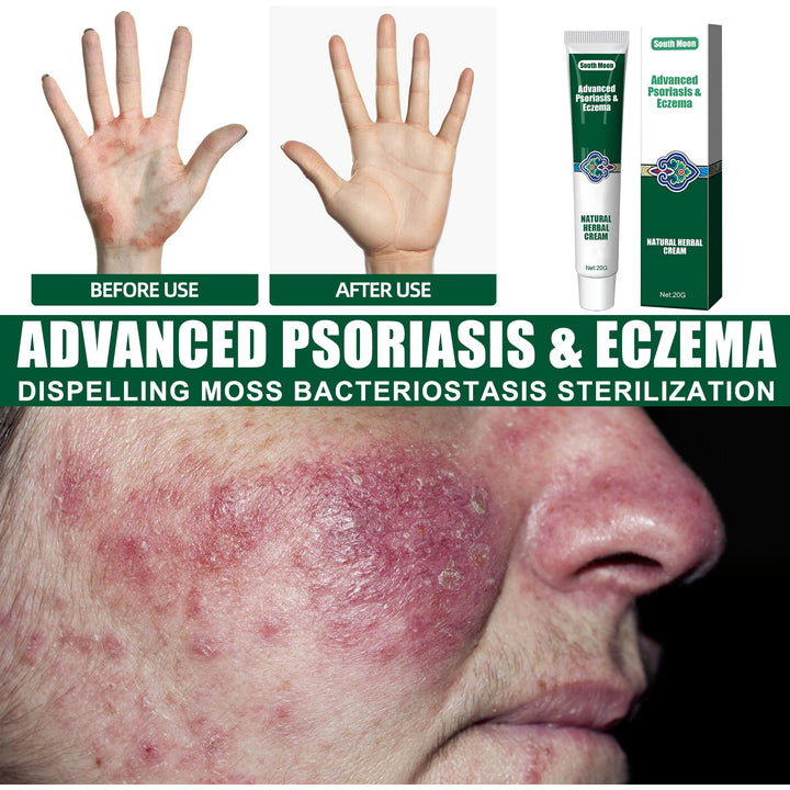 Herbal Soothing Cream for Dry, Itchy & Irritated Skin