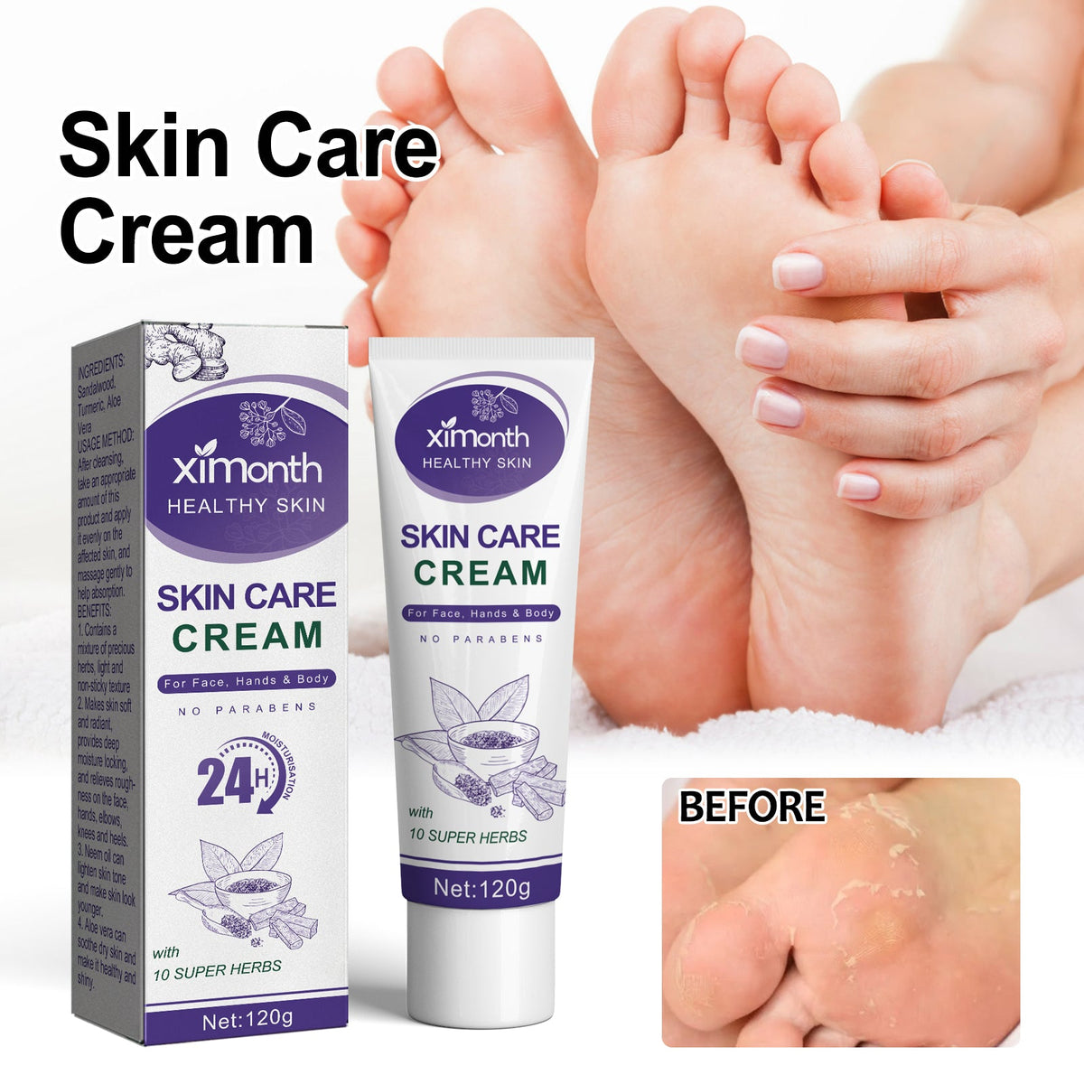 Herbal Body Cream for Cracked Heels & Dry Winter Skin