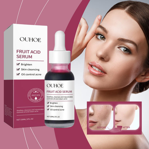 Fruit Acid Serum for Oily Skin, Pores & Brightening