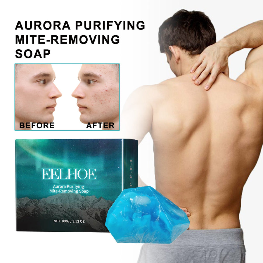 Aurora Mite-Removing Soap for Acne-Prone Skin