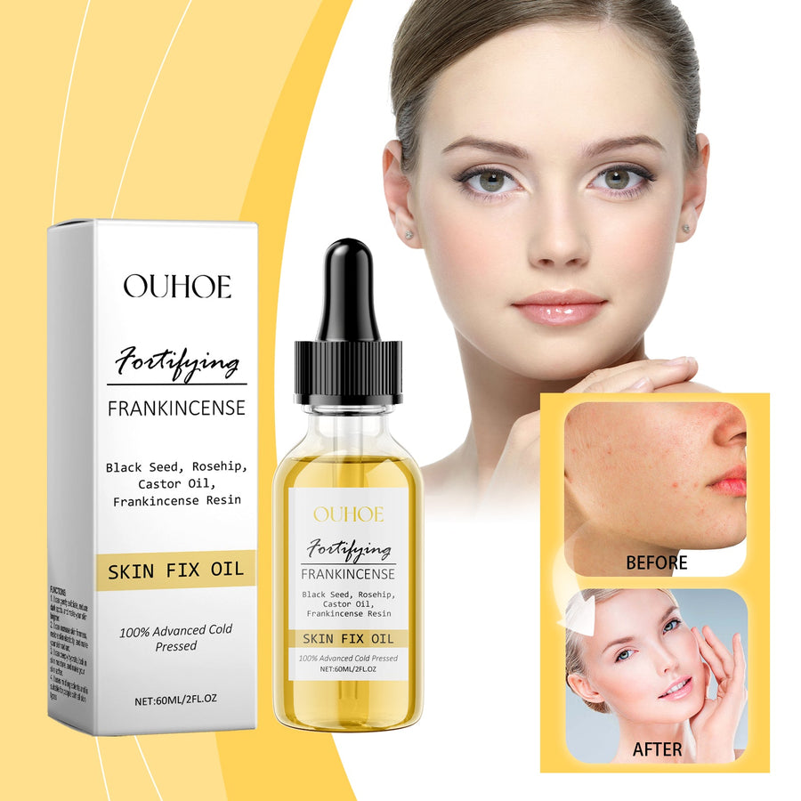 Frankincense Facial Oil for Texture and Firmness