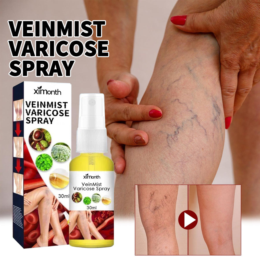 Varicose Vein Relief Spray — Smoother, Comfortable Legs