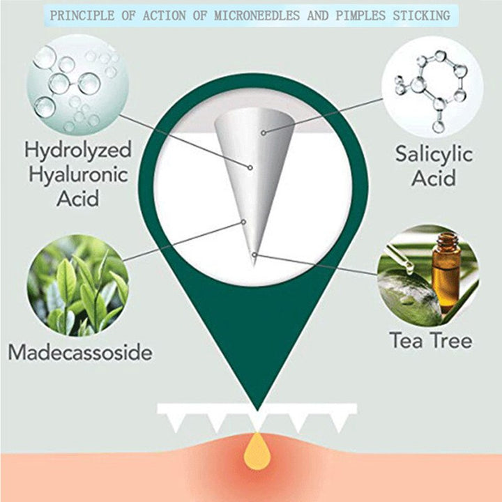 Microneedle Pimple Patch — Clear Pimples in 8 Hours