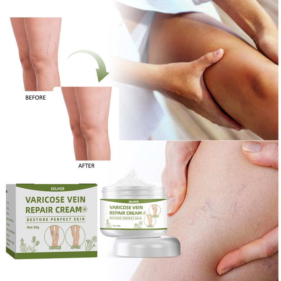 Varicose Vein Repair Cream — Reduces Spider Vein Appearance