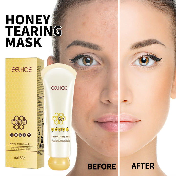 Honey Peel Mask for Blackhead Removal & Brighter Skin