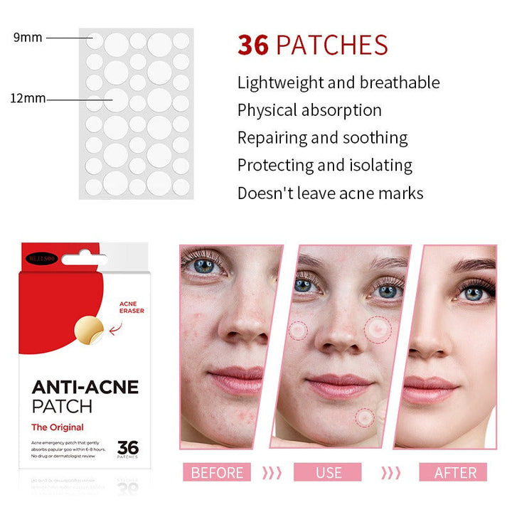 Acne Patches: Invisible Blemish Protection Overnight