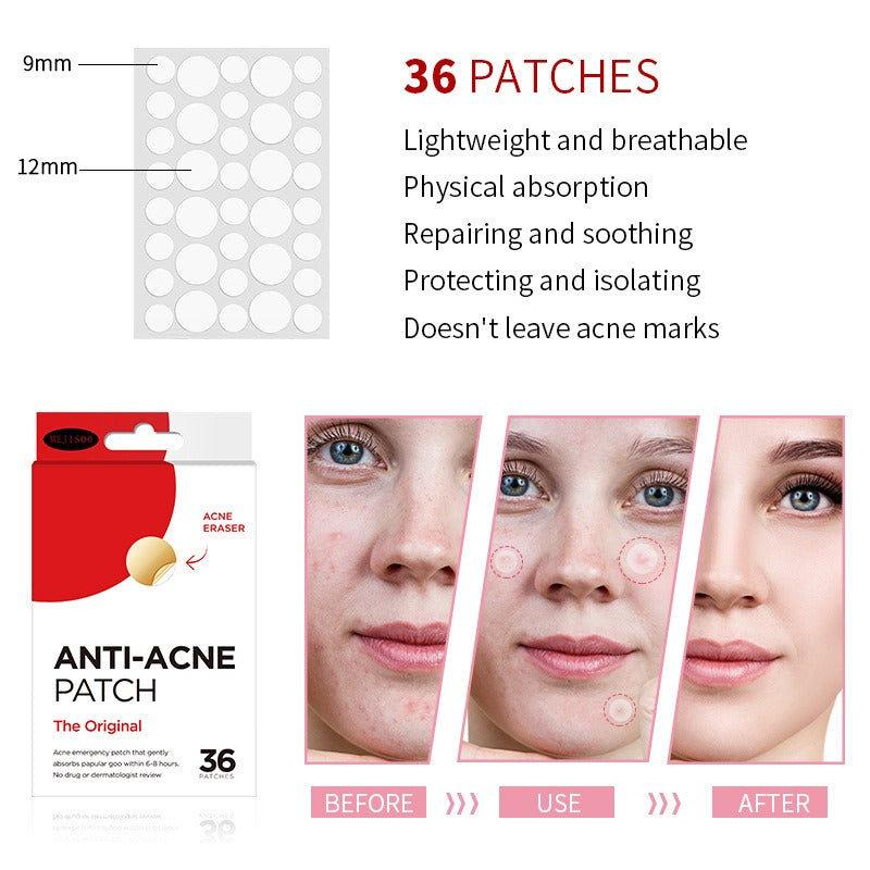 Acne Patches: Invisible Blemish Protection Overnight
