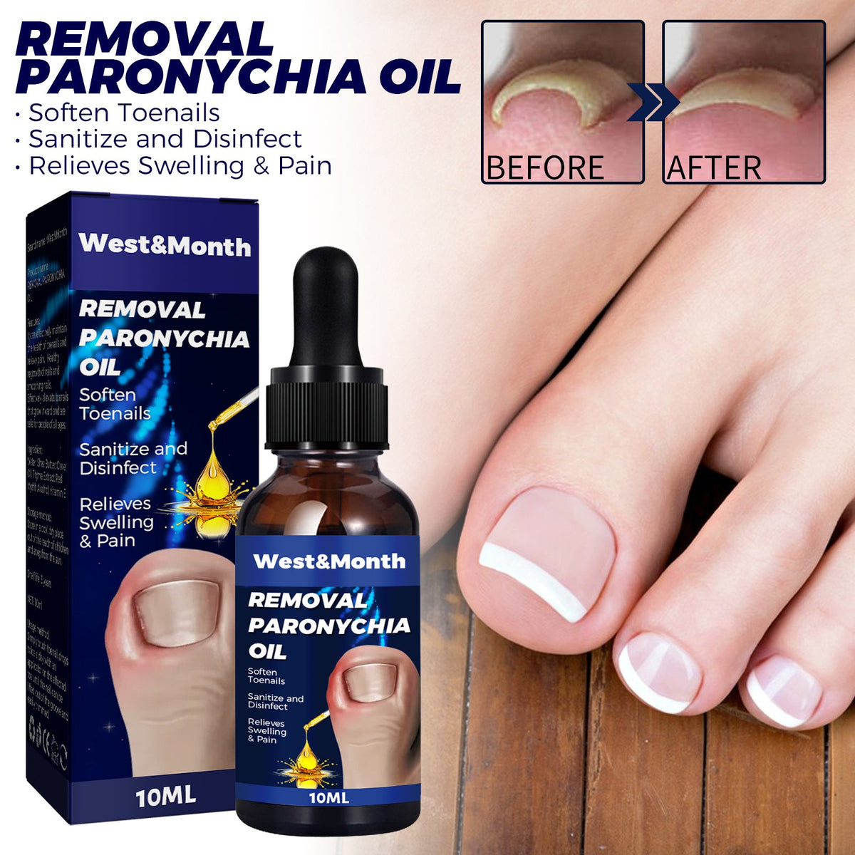 Nail Repair Oil for Ingrown Toenails & Paronychia Relief