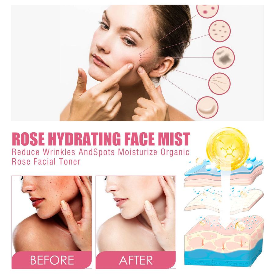 Rose Face Mist Toner for Hydrating, Brighter Skin