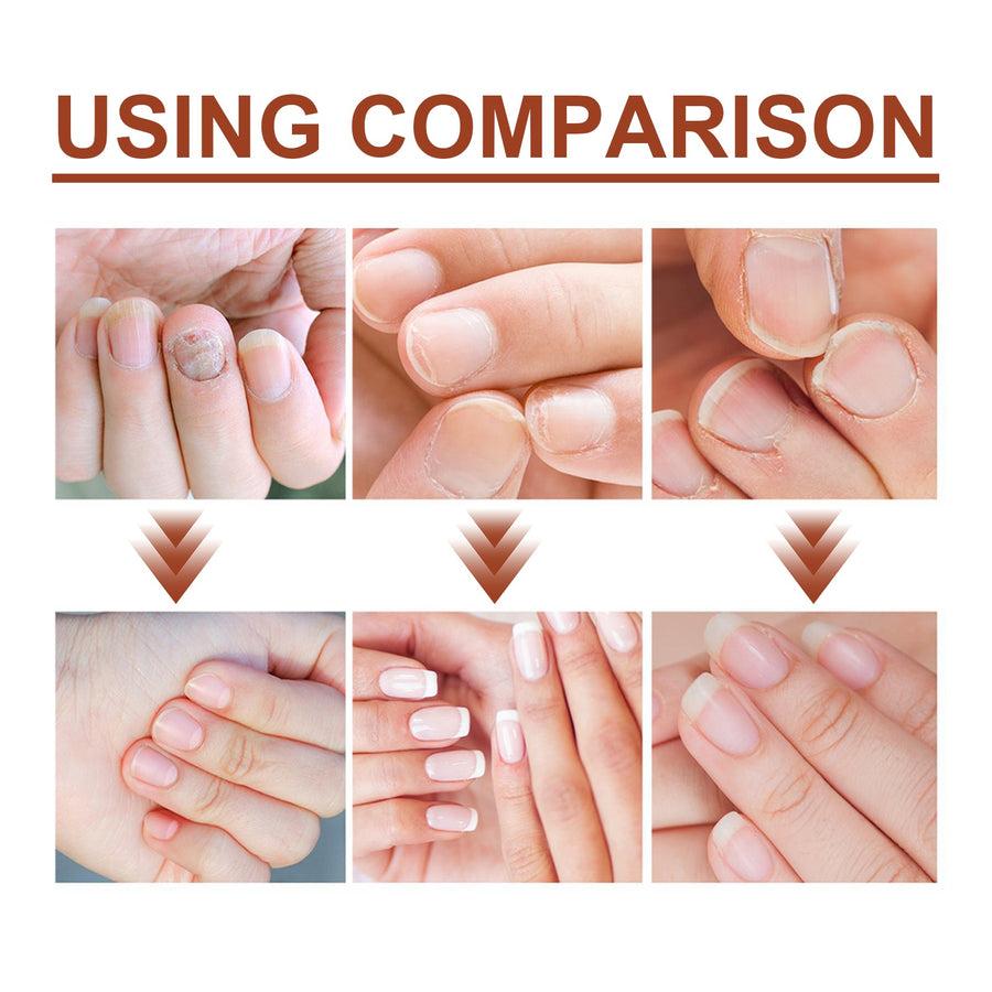 Nail Repair Serum for Stronger, Hydrated, Healthy Nails