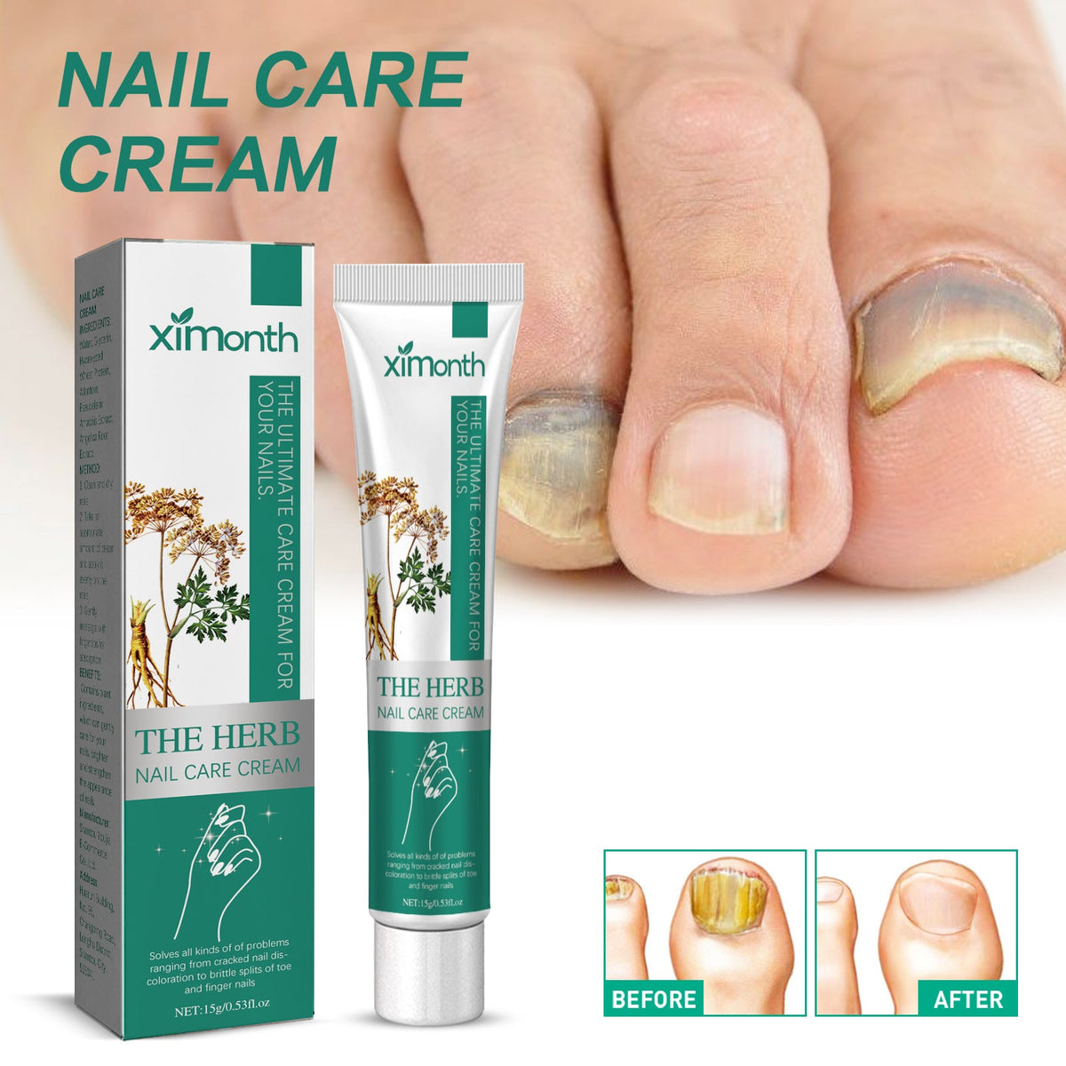 Nail Repair Cream for Grey, Brittle & Thickened Nails