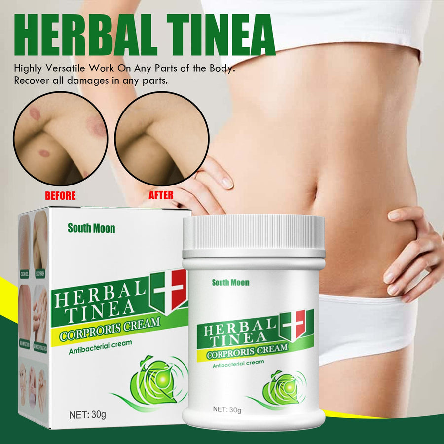 Herbal Tinea Cream for Fungal Itch & Rash Relief