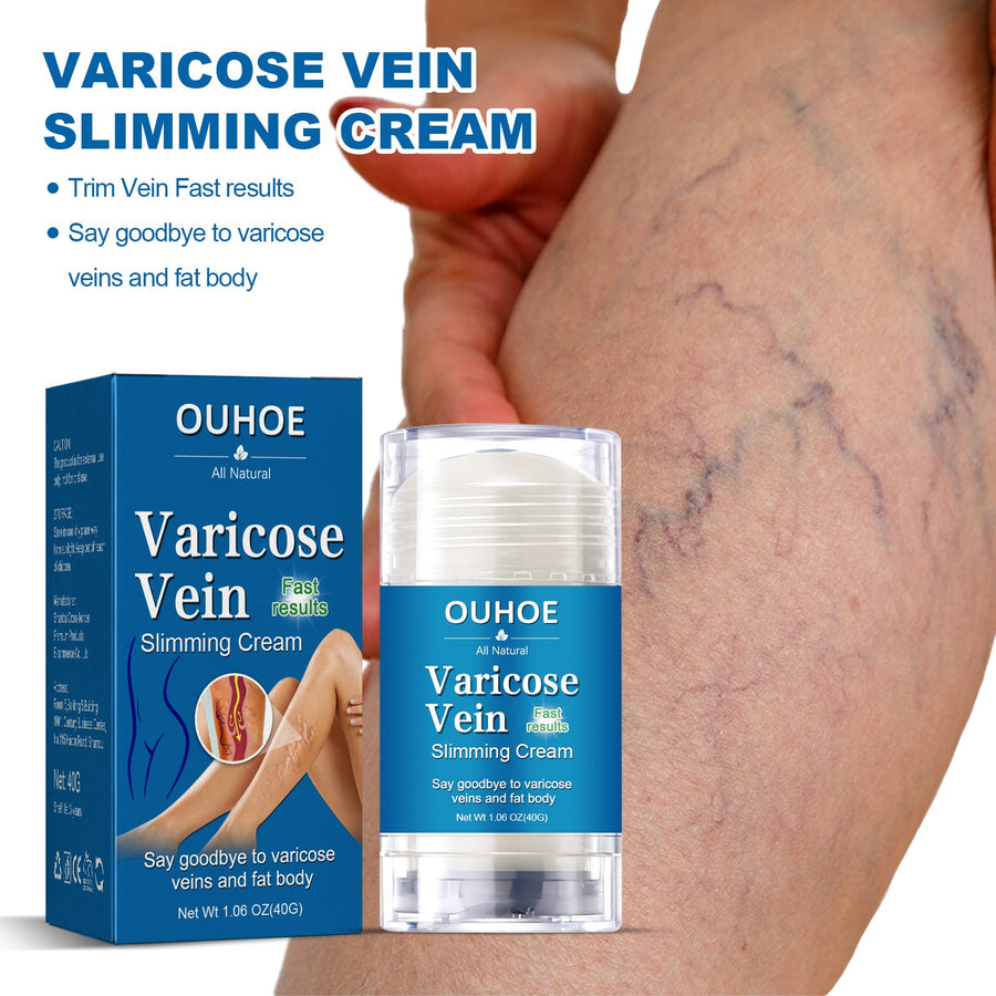 Natural Varicose Vein Cream – Reduces Leg Swelling & Veins