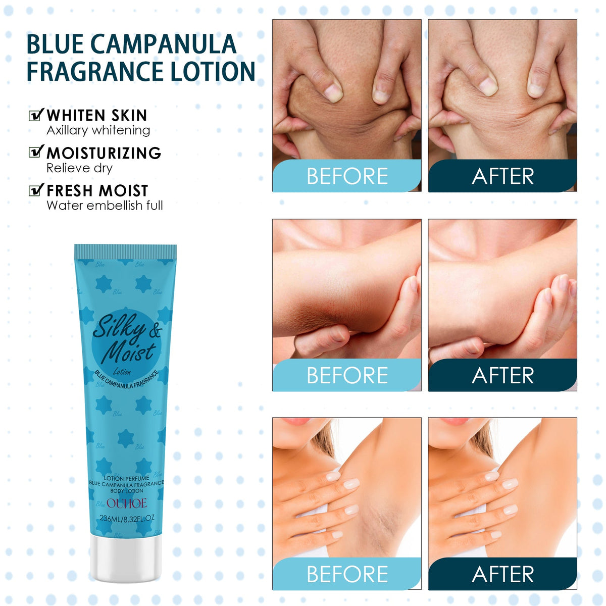 Skin Whitening Body Lotion – Brightens Armpits, Knees & Joints