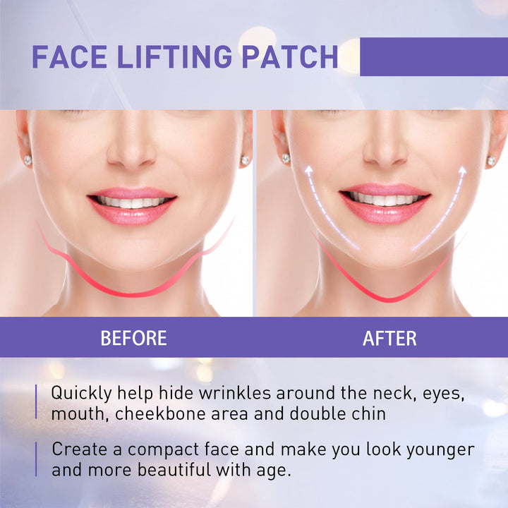 V-Shaped Face Lifting Patches for Temporary Contour